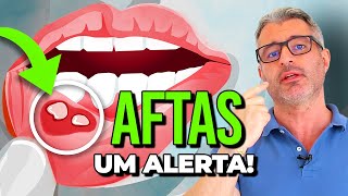 O que significa ter AFTAS e como evitálas 🔴 [upl. by Duma]