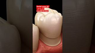 tooth cap  dental crown  dental animations 3D shorts [upl. by Hoj]