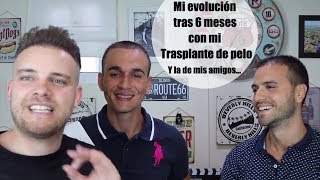 Vlog 5 Mi evolución tras 6 meses del trasplante de pelo y la de mis AMIGOS [upl. by Etterual]