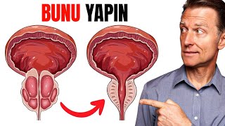 Büyümüş Prostatı Küçülten TEK YİYECEK  Dr Berg Türkçe [upl. by Salina]