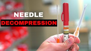 How To Chest Needle Decompression [upl. by Broadbent]