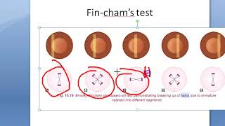 Ophthalmology Colored Halo Causes FINCHAM TEST Coloured Halos [upl. by Wymore358]