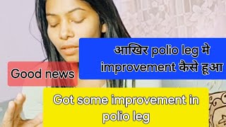 Can we improve polio leg  क्या polio leg को improve किया जा सकता [upl. by Ailimaj]