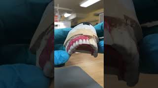 Please subscribe for moredentist dentalprosthesisadvancedorthodontics dentalclinicorthodontist [upl. by Bate]