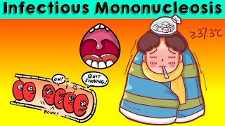 Infectious Mononucleosis IMNGlandular Fever  Causes Signs amp Symptoms Diagnosis amp Treatment [upl. by Ennaerb]