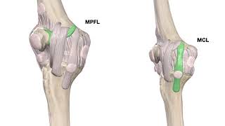 The Art of medial release during TKR for Varus Knee [upl. by Carboni808]