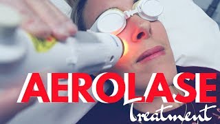 Aerolase Laser Treatment Review  AntiAging And Acne Skin Care [upl. by Galatea]