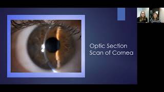 Lecture Using the Slit Lamp Microscope to Visualize the Ocular Structures [upl. by Vanya]