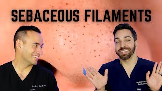 Black Dots on the Nose Heres How To Treat Sebaceous Filaments [upl. by Ester]