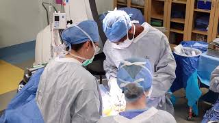 Mayo Clinic Minute  Correcting the curve with scoliosis surgery [upl. by Riccardo]