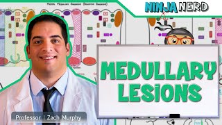 Medullary Lesions Medial and Lateral Medullary Syndromes [upl. by Almeida]