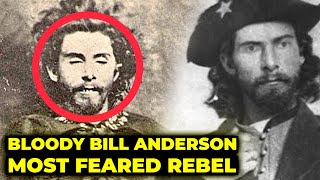 Bloody Bill Anderson The Most Pitiless Guerrilla Warrior of the Civil War [upl. by Lahcym507]