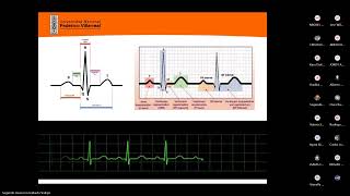 fisiopatología  CARDIOLOGÍA II arritmias cardiacas [upl. by Mccoy]