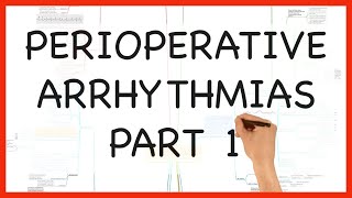 PERIOPERATIVE ARRHYTHMIAS PART 1 [upl. by Yasnil]