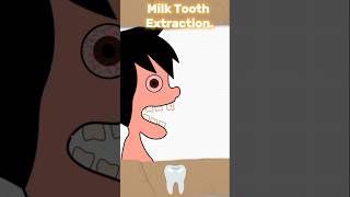 Milk Tooth Extraction🦷🦷 funny brainygames shorts games ytshorts [upl. by Kev164]