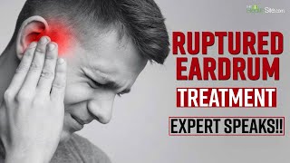 Ruptured Eardrum What Treatment According To Expert Should Be Done For Perforated Eardrum [upl. by Eleon675]