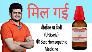 1 Best Homeopathic Medicine for Urticaria  हमेशा के लिए शीतपित्त या पित्ती का अंत सिर्फ एक दवा से [upl. by Venita509]