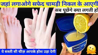 Hands Feet Whitening Cream  homemade Manicure Pedicure  Monsoon Skincare routine [upl. by Warring]