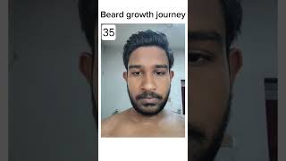 Beard growth journey beard beardstyle mensgrooming [upl. by Auka51]