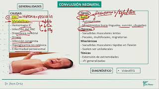 Neonatología  Convulsion neonatal [upl. by Noneek]