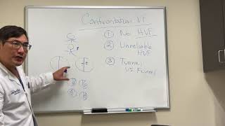 Confrontation Visual Fields testing [upl. by Palumbo]