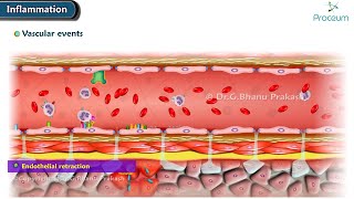 2 Acute Inflammation Vascular Events Animation [upl. by Nnylhtak]