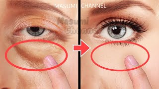 9mins Eye Bags Removal Exercises Lift Up Dark Circles Under Eyes Eye Wrinkles AntiAging [upl. by Damaris]