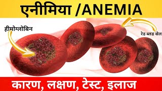 एनीमिया  anemia क्यों होता है Iron ki kami se hone wala anemia iron deficiency anemia [upl. by Milon171]