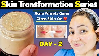 Glass Skin Transformation Series Day 2  Get Clear Healthy Glowing Spotless Glass Skin in 5 Days💕 [upl. by Ynaffital]