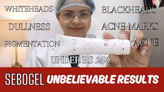 SEBOGEL Use like this for Unbelievable Results अनगिनत फायदे trending skin ojas [upl. by Eldwun]