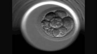 INSTITUT MARQUÈS  Desarrollo de un embrión humano visto con el Embryoscope [upl. by Shamrao]