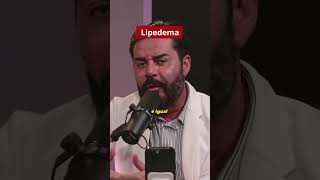 Sofre com Lipedema Vou te explicar AGORA [upl. by Fonzie]