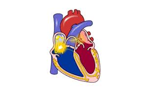 Another use for Diltiazem Supraventricular Tachycardia [upl. by Ybeloc784]