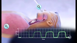 Capnography Made Easy [upl. by Pigeon]