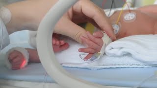 Bubble CPAP for Increased Lung Function in Premature Babies with Hany Aly MD [upl. by Marthena]