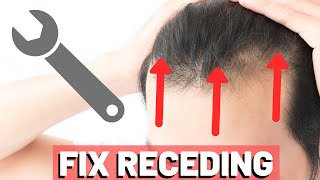 5 POWERFUL Receding Hairline TRICKS to INSTANTLY Improve Your Look [upl. by Fabiolas]