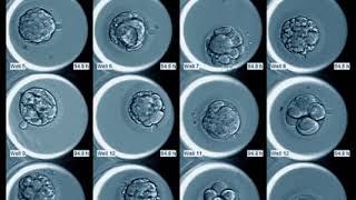 ตู้เลี้ยงตัวอ่อน EmbryoScope Plus  Smile IVF [upl. by Ecille]