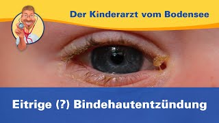 Eitrige  Bindehautentzündung — Der Kinderarzt vom Bodensee [upl. by Adnaloj]