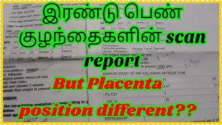 girlpregnancy scan report forgirl babyPlacenta anterior or posteriorGirlbaby scan detailsintamil [upl. by Rorrys31]