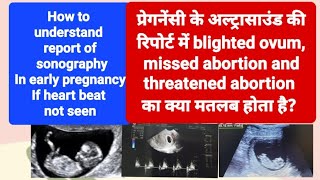 blighted ovum Incomplete or missed abortion का ultrasound रिपोर्ट मे क्या मतलब होता है [upl. by Nirak]