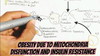 Obesity Due To Mitochondria Disfunction And Insulin Resistance Interplayobesity [upl. by Schnurr]