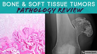 Bone amp Soft Tissue Pathology Board Review 21 Classic Cases [upl. by Sinnylg]