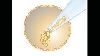 Embryonic Stem Cells and Somatic Cell Nuclear Transfer [upl. by Wohlert]