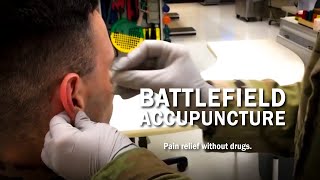 Pain Relief without Drugs Battlefield Acupuncture [upl. by Ushijima851]