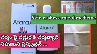 skin rashes control with Atarax lotion amp Z mont fx tablet amp xyzal l dermatologist prescription [upl. by Melesa524]