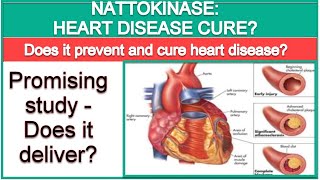 Nattokinase The Cure to Heart Disease [upl. by Marietta197]