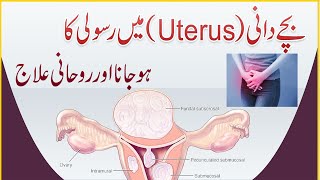 Bachedani Uterus Mein Rasoli Ka Ho jana  Rasoli Ko Khatam Karne Ka Rohani Ilaj  Dua Program [upl. by Rana645]