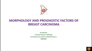 Short Review General Overview of Invasive Lobular Carcinoma Breast [upl. by Aiotal]