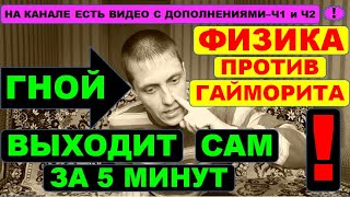 ГАЙМОРИТ СИНУСИТ ГНОЙ вылетит сам⚠️силами ФИЗИКИ ☝️ Мгновенное лечение МЕТОДОМ САМОПРОДУВКИ✔ [upl. by Wehrle]