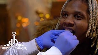 Lil Durk Gets Permanent Grill Done by Johnny Dang Himself  Discusses when YNW Melly gets out [upl. by Astri]